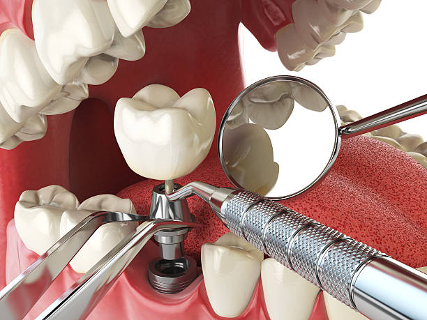 Best Cosmetic Emergency Dentistry in Southern Gateway, VA